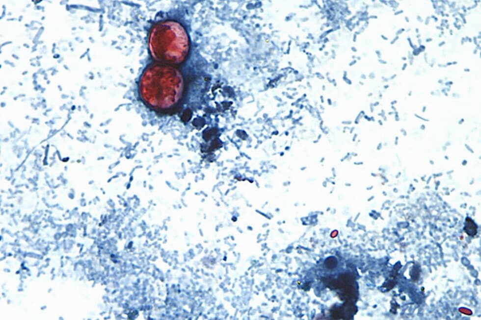 Two US Deaths Linked to Cyclospora Parasite Reported in Michigan - Image 2